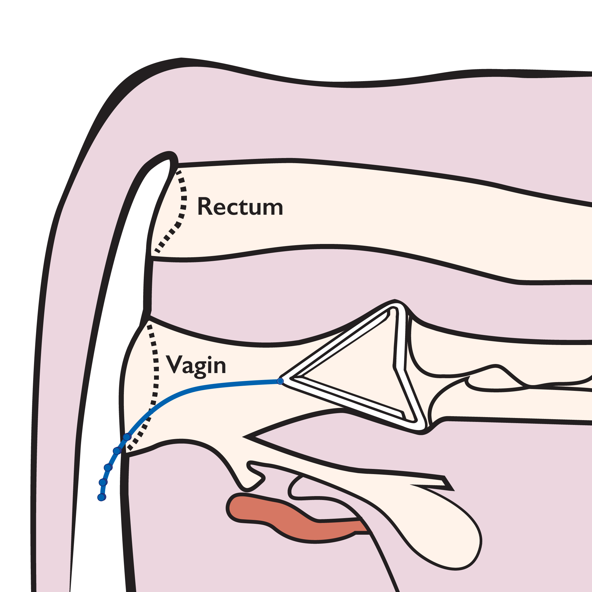 cow diagram